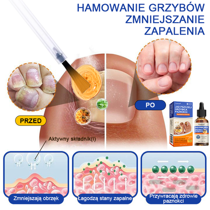 🐝👣Pureluxo® Bienengift Nagelpilz Leczenie: Całkowite rozwiązanie problemu grzybicy paznokci🌟👣👣