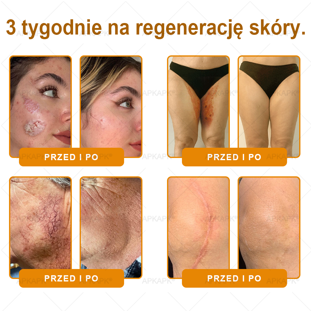 Polecane przez USK w Białymstoku · Wyprodukowano w Polsce✨✨ 𝖠𝖯𝖪𝖠𝖯𝖪® krem regenerujący skórę z jadem pszczelim💰✨✨✨✨