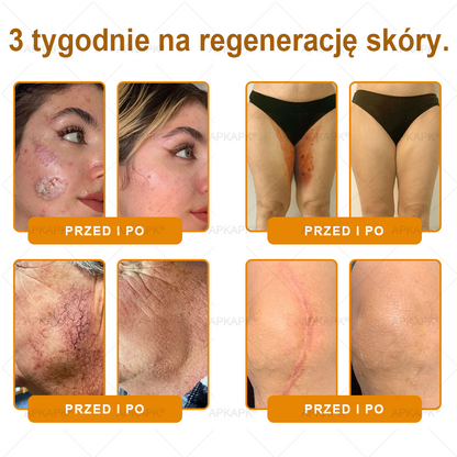 Polecane przez USK w Białymstoku · Wyprodukowano w Polsce✨✨ 𝖠𝖯𝖪𝖠𝖯𝖪® krem regenerujący skórę z jadem pszczelim💰✨✨✨✨