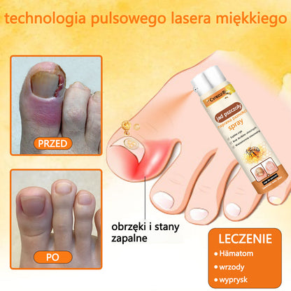 👣Spray z jadem pszczelim na paznokcie✅ Certyfikowany przez PTD👣