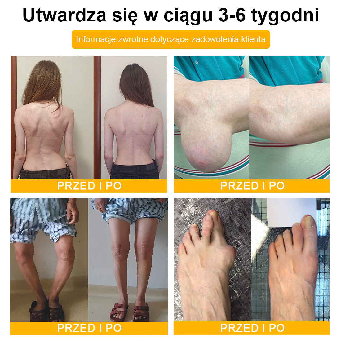 🦴𝑷𝒖𝒓𝐞𝐿𝒖𝒙𝐨® Toksyna botulinowa i jad pszczeli Krem przeciwbólowy do gojenia kości🦴🦴