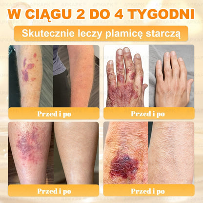 Polecane przez USK w Białymstoku · Wyprodukowano w Polsce✨✨ 𝖠𝖯𝖪𝖠𝖯𝖪® krem regenerujący skórę z jadem pszczelim💰✨✨✨✨