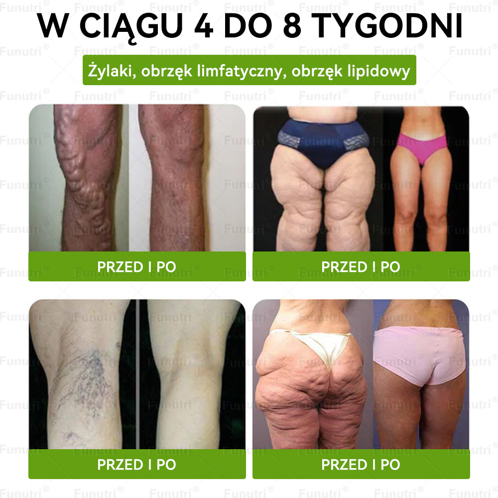 Oficjalny Sklep 👩‍⚕️👩‍⚕️Funutri® 10 w 1 metaboliczny wyszczuplający plaster z nanomikroigłami  (Tylo raz dziennie – widoczne zmiany już w 7 dni)Wsparcie przy otyłości, cukrzycy, bezdechu sennym, problemach ze stawami i nie tylko👩‍⚕️👩‍⚕️👩‍⚕️👩‍⚕️