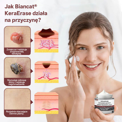 Pureluxo®KeraErase Krem odnawiający o podwójnym działaniu🔥