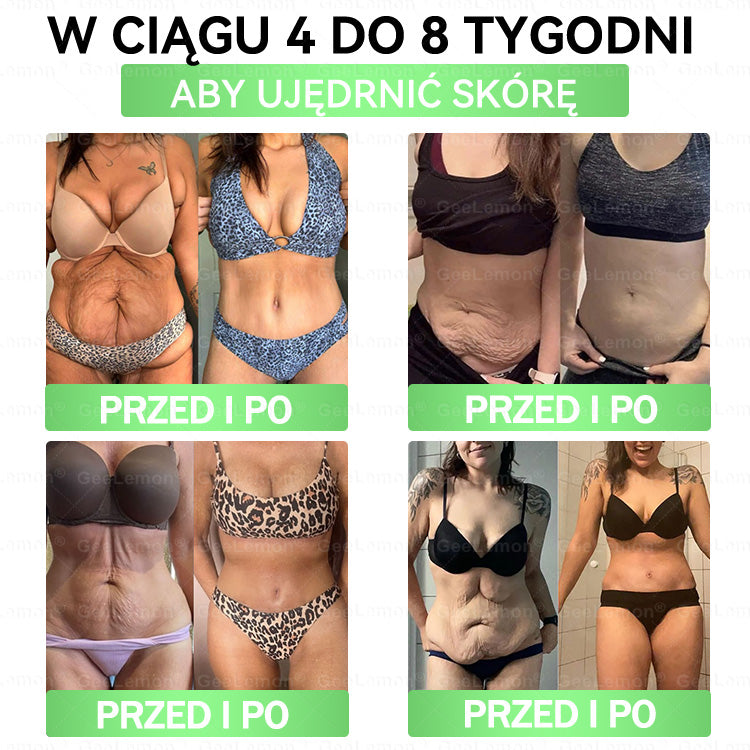 👩‍⚕️Oficjalny Sklep | 🎁 Pureluxo® 𝐆𝐥𝐮𝐦ase𝐭𝐢𝐝𝐞 𝟖 𝐰 𝟏 Smukły i Zdrowy Nano Plaster z Mikronakłuciami 🇵🇱(Tylko raz dziennie, widoczne zmiany już w 7 dni)✅ Na otyłość, 🅛🅞🅞🅢🅔 🅢🅚🅘🅝 wiotką skórę, cukrzycę, bezdech senny, problemy ze stawami i wiele więcej🎅🎅🎄🎄🎄🎄