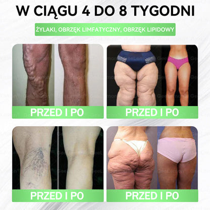👩‍⚕️Oficjalny Sklep | 🎁 Pureluxo® 𝐆𝐥𝐮𝐦ase𝐭𝐢𝐝𝐞 𝟖 𝐰 𝟏 Smukły i Zdrowy Nano Plaster z Mikronakłuciami 🇵🇱(Tylko raz dziennie, widoczne zmiany już w 7 dni)✅ Na otyłość, 🅛🅞🅞🅢🅔 🅢🅚🅘🅝 wiotką skórę, cukrzycę, bezdech senny, problemy ze stawami i wiele więcej🎅🎅🎄🎄🎄🎄