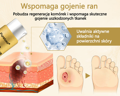Pureluxo® Leczniczy spray do stóp cukrzycowych- zawiera jad pszczeli, który przyspiesza gojenie i zapobiega infekcjom!🌿🌿🌿🌿🌿