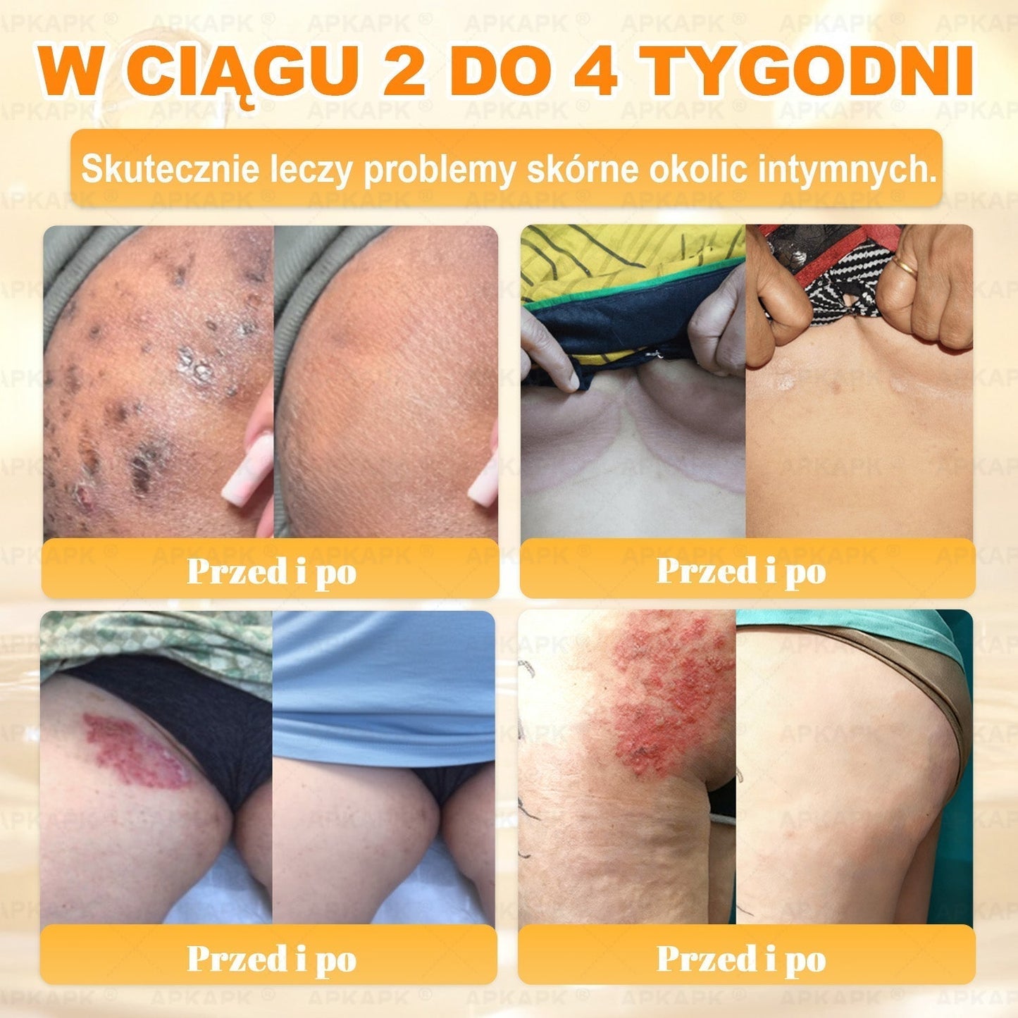 Polecane przez USK w Białymstoku · Wyprodukowano w Polsce✨✨ 𝖠𝖯𝖪𝖠𝖯𝖪® krem regenerujący skórę z jadem pszczelim💰✨✨✨✨