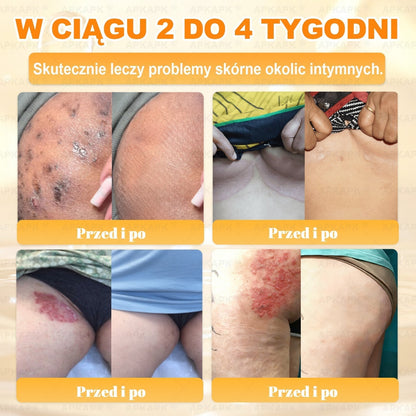 Polecane przez USK w Białymstoku · Wyprodukowano w Polsce✨✨ 𝖠𝖯𝖪𝖠𝖯𝖪® krem regenerujący skórę z jadem pszczelim💰✨✨✨✨