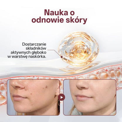 Pureluxo®KeraErase Krem odnawiający o podwójnym działaniu🔥