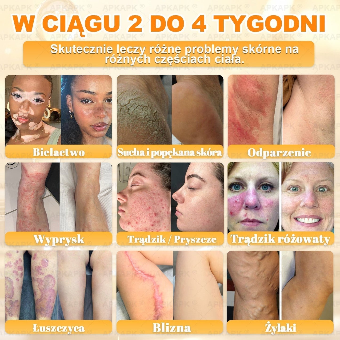 Polecane przez USK w Białymstoku · Wyprodukowano w Polsce✨✨ 𝖠𝖯𝖪𝖠𝖯𝖪® krem regenerujący skórę z jadem pszczelim💰✨✨✨✨