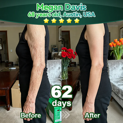 （Oficjalnie certyfikowane i wyłącznie autoryzowane）☘️ Pureluxo® Serum z komórkami macierzystymi i peptydami kolagenu 🪄 （Ujędrnia skórę i redukuje widoczność zmarszczek）☘️