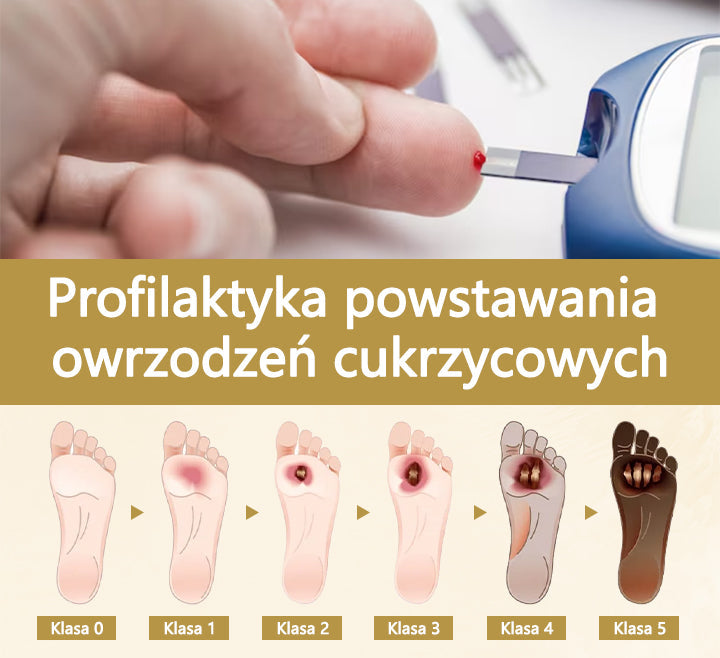 Cvreoz® Leczniczy spray do stóp cukrzycowych- zawiera jad pszczeli, który przyspiesza gojenie i zapobiega infekcjom!🌿