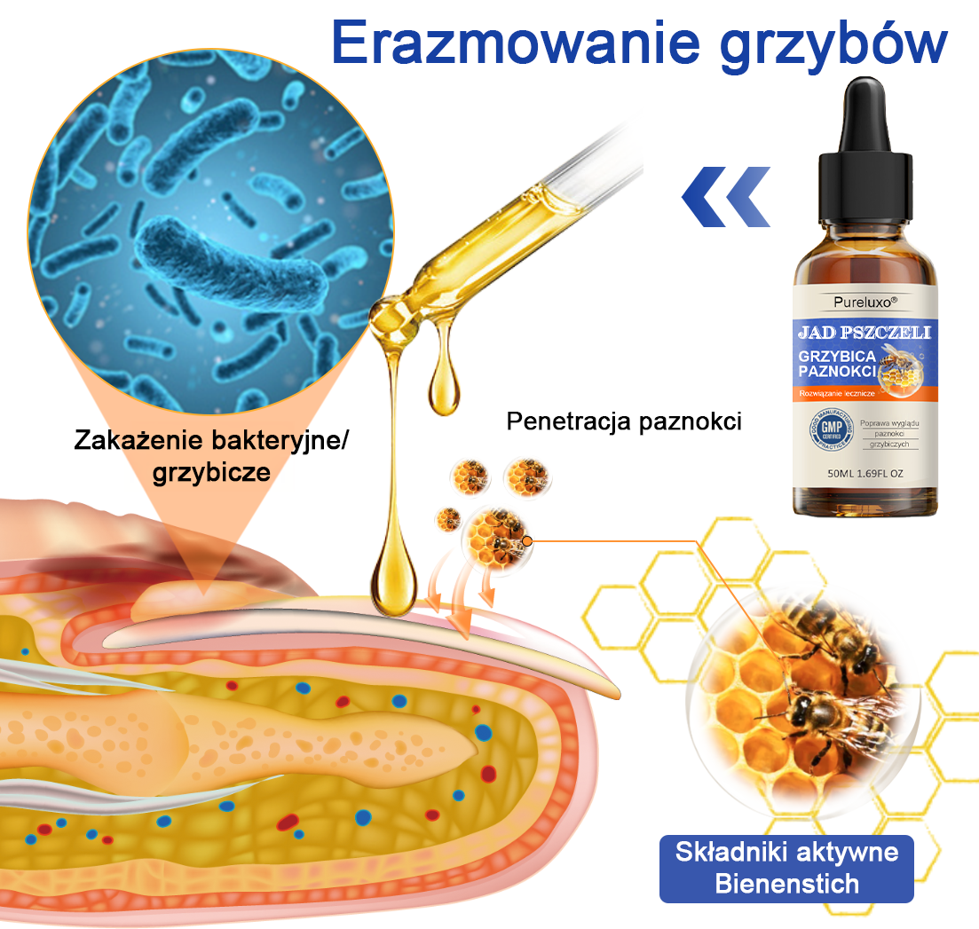 🐝👣Pureluxo® Bienengift Nagelpilz Leczenie: Całkowite rozwiązanie problemu grzybicy paznokci🌟👣👣