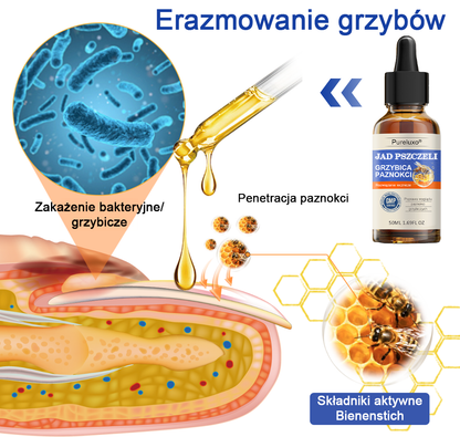 🐝👣Pureluxo® Bienengift Nagelpilz Leczenie: Całkowite rozwiązanie problemu grzybicy paznokci🌟👣👣