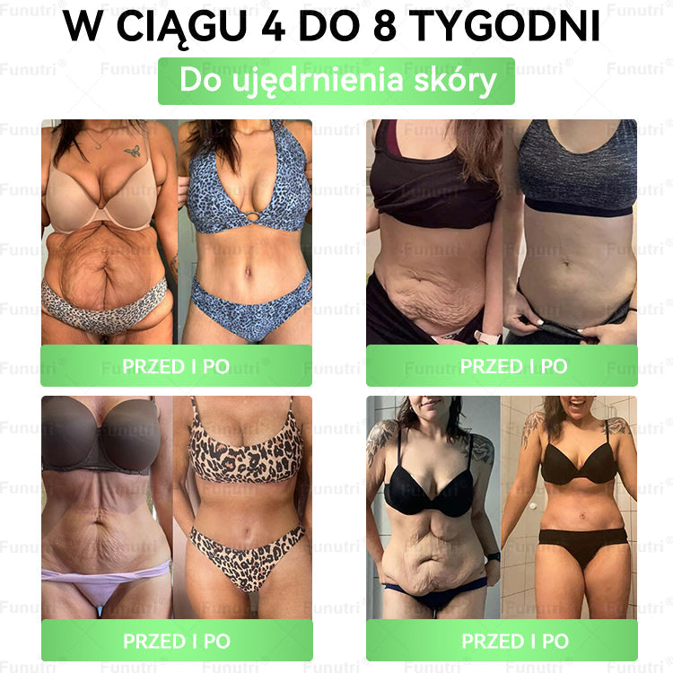 Oficjalny Sklep 👩‍⚕️👩‍⚕️Funutri® 10 w 1 metaboliczny wyszczuplający plaster z nanomikroigłami  (Tylo raz dziennie – widoczne zmiany już w 7 dni)Wsparcie przy otyłości, cukrzycy, bezdechu sennym, problemach ze stawami i nie tylko👩‍⚕️👩‍⚕️👩‍⚕️👩‍⚕️